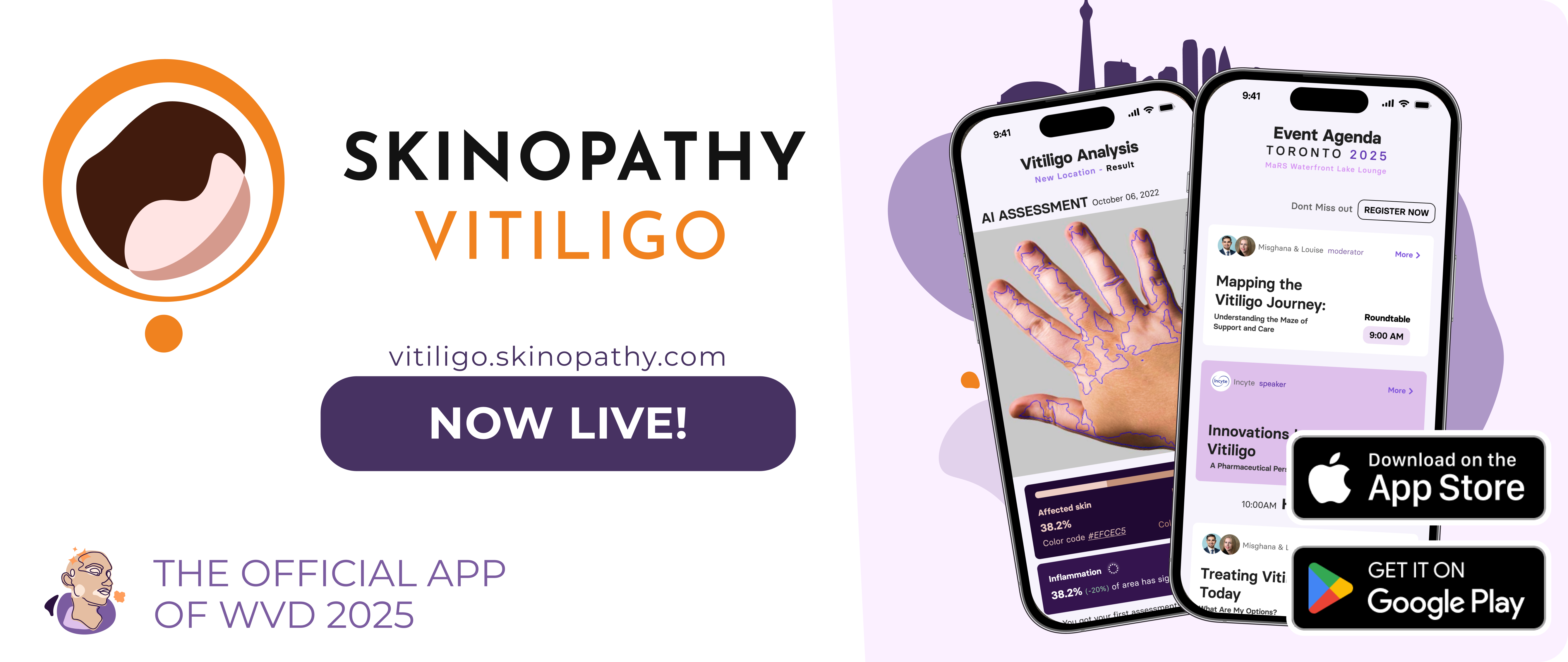 World Vitiligo Day 2025 - REGISTER NOW