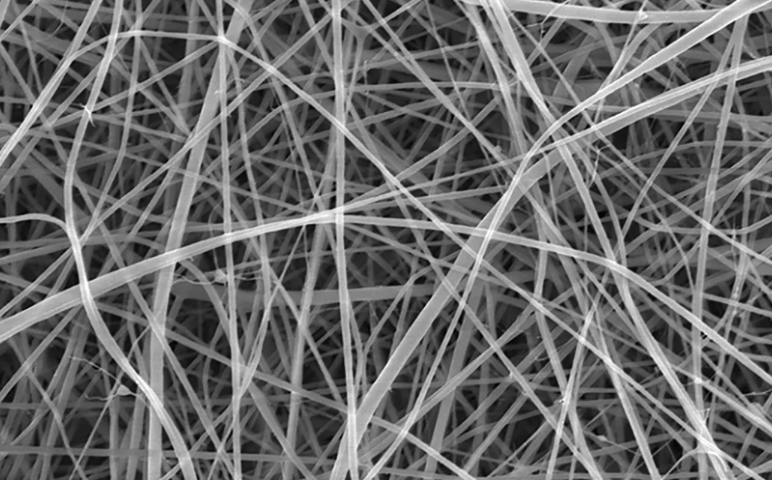 Black and white strands going in every direction
