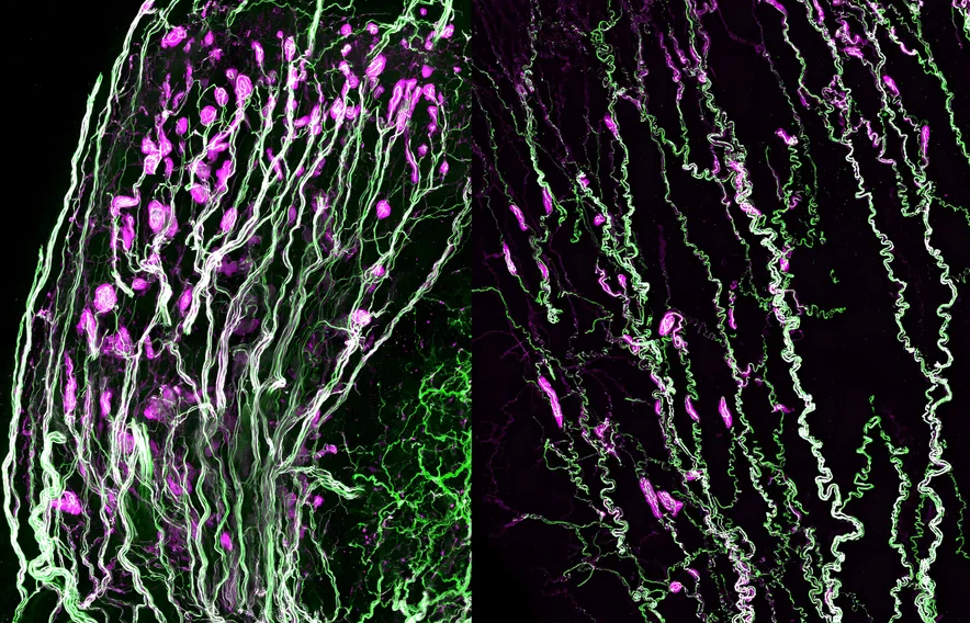 Electron micrographs of branching mouse sensory nerve cells in purple and green